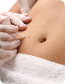 Carboxiterapia